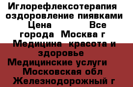 Иглорефлексотерапия, оздоровление пиявками › Цена ­ 3 000 - Все города, Москва г. Медицина, красота и здоровье » Медицинские услуги   . Московская обл.,Железнодорожный г.